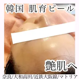韓国発ララピール！シワ、たるみ、ニキビ跡、毛穴、くすみ、などなどでお悩みの方にオススメ