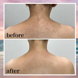 【顔うなじ、背中、デコルテ、両腕肩から指先まで】