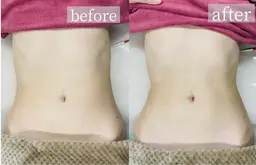 【オープン記念】最新NR機器で、ほっそり美ボディーに✨（※お顔以外）ダイエット❣️マッサージとしても⭕️