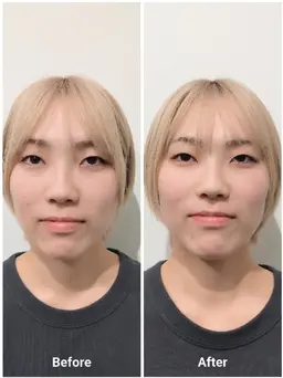 【平日限定】小顔矯正45分¥2,200-