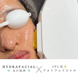 🫧ハイドラ 毛穴洗浄(全顔)💕美白美容液導入+光フォト付き(シミ/赤らみ) ¥11,300→9,500