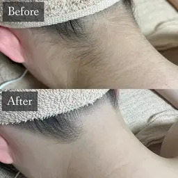 🚺【レディース背面脱毛】(補足説明を確認してください)1回のみの使用可能です☘️お好きなパーツのみ綺麗にしたい方に🌟