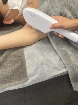🎀 キレイの第一歩💖　両ワキ脱毛モデル募集✨5回 5,000円✨
