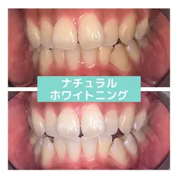 【期間限定メニュー】20分照射  3960円
