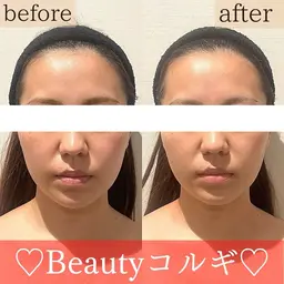 《初回限定》🧠【顔も思考もスッキリ✨】こりとりコルギ＋頭ほぐし🧖‍♀️90分