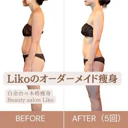 【🔥速攻痩せならこれ！🔥】マグスリム＆スターテックで本格痩身★60分【ハイパーナイフ】【EMS】【吸引】