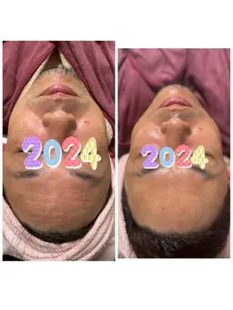 【メンズフェイシャル】　メンズもお肌きれいにしませんか？メンズ専用のフェイシャルエステ60分