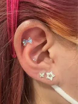 耳つぼジュエリー （両耳10粒まで）