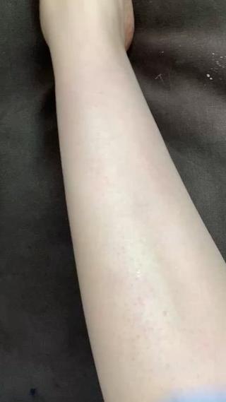シュガーリングとは砂糖・水・レモンだけでできた優しいナチュラル脱毛
古代から愛される脱毛法でつるすべ肌へ導きます
チクチクしにくく敏感肌にもおすすめ