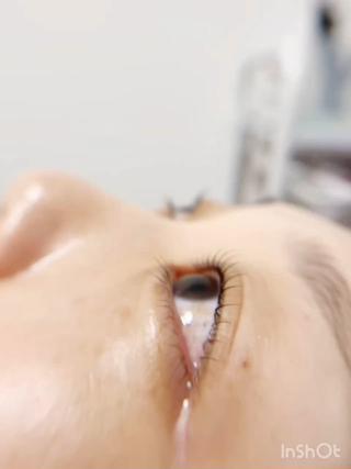 #一重まぶた