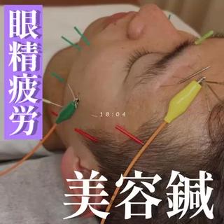 眼精疲労 