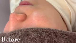 倉敷/玉島/20代 からの大人毛穴洗浄のエステ・リラクイメージ