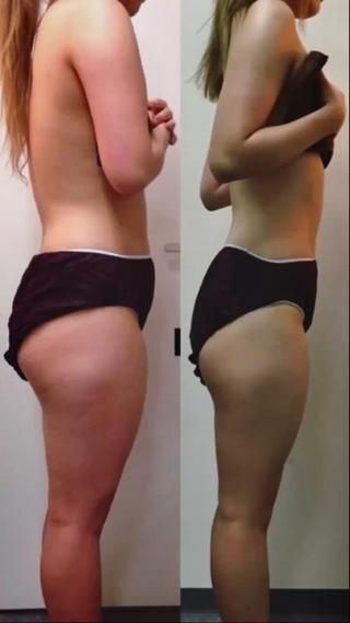 一人一人に合わせた痩身ダイエット施術で全身キレイに