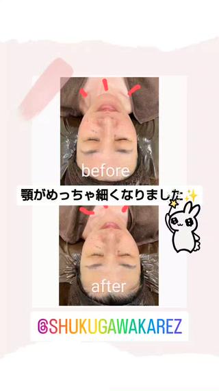 小顔矯正夙川 カレーズのエステ・リラクイメージ
