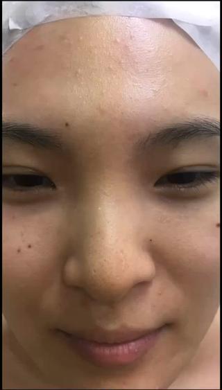 本気の肌質改善しましょう!