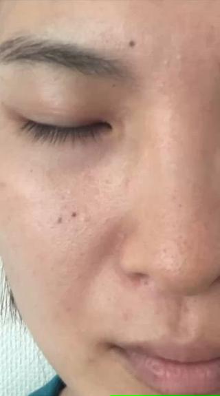 透明感あふれる毛穴レス陶器肌へ!