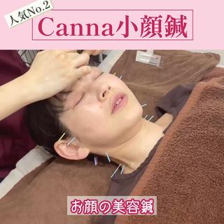 「小顔針(美容鍼+小顔矯正付き)」
美容鍼に小顔矯正をプラスした、よりフェイスラインに特化した施術。
アゴの関節の硬さや歪みにアプローチすることで、お顔の左右差・たるみ・エラ張りスッキリ◎
さらにお身体からも整えることで、小顔効果の持続力アップもさらに期待できます。
【施術の流れ】
カウンセリング→お顔の針→お身体の針→小顔矯正→フェイシャルマッサージ→保湿
【施術時間】
約120分(カウンセリング30分含む)