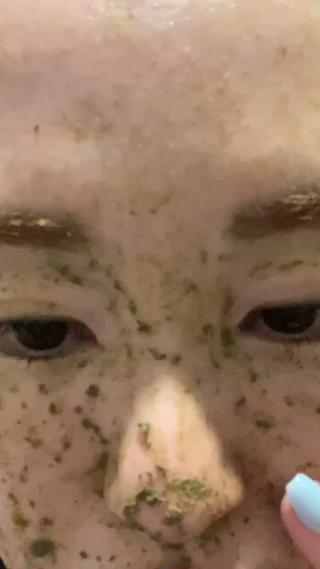 剥離ありピーリング
《マイルドタイプ》※しっかりタイプもございます。
オーナー私の肌を改善したのはこれです。
繰り返すニキビ/毛穴全般/肌の凹凸/跡などのトラブルにお悩みのお客様はこちらでご予約くださいませ
韓国肌を目指すならこれ
========
KALANCHOE
中目黒駅徒歩3分
【営業時間】
月~金/09:30~21:00
土日祝/11:00~20:00
========
どんなお肌悩みもご相談くださいませ
2回目以降も続けやすい特典あり
・ニキビケア/跡/凸凹改善
・乾燥/ゴワつき/ザラつき
・毛穴全般
・くすみなど
その他