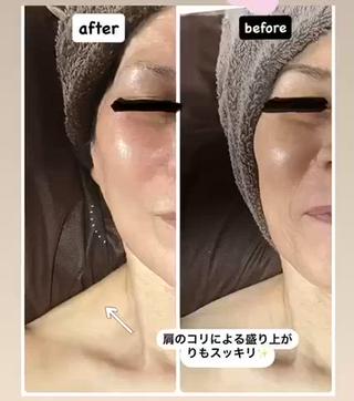 lymph coconのエステ・リラクイメージ