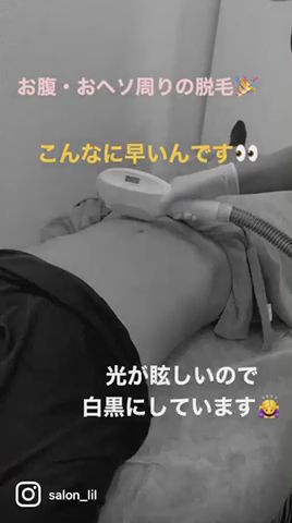 お腹・おヘソ周りの脱毛施術ほぼ1分で終了です