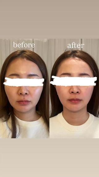 total beauty Aimのエステ・リラクイメージ