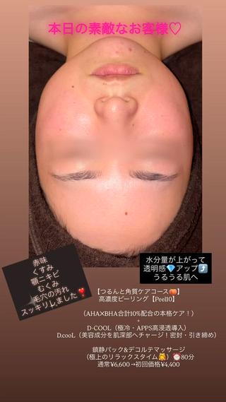lucia  豊明 肌管理のエステ・リラクイメージ