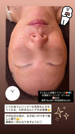 lucia  豊明 肌管理のエステ・リラクイメージ