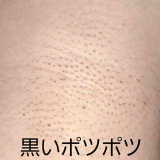 脇の黒ずみも取れます
黒ずみがある方にオススメです 