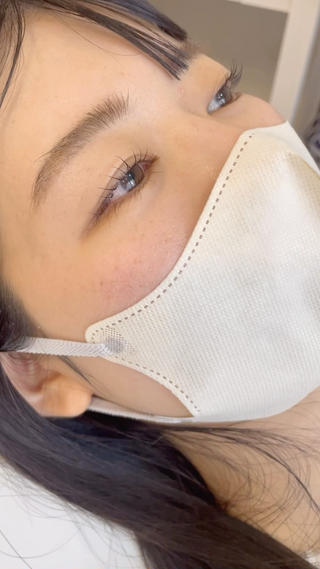 瞬きするたび美しい
