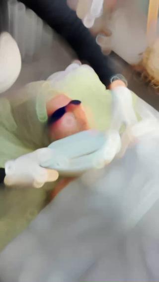 人気のフェイシャル脱毛