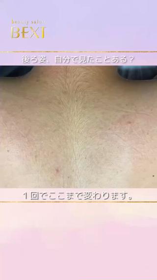 #せなか脱毛 #背中脱毛 #全身脱毛 #レディース脱毛 #メンズ脱毛 #部分脱毛 #名古屋脱毛 #名駅脱毛