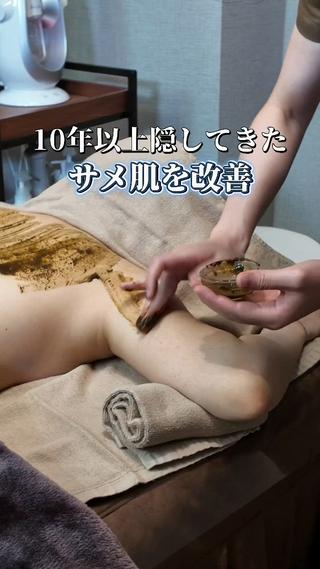 二の腕の毛孔性苔癬に長年お悩みだったお客様‬
その日の肌状態を確認しながら一人ひとりに合わせた施術を行っています️
この日は、お客様の肌状態やお悩みに合わせて毛穴洗浄を選び、施術させていただきました 