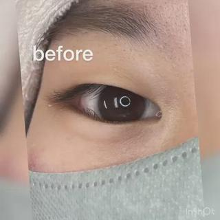 逆まつげで悩んでる方
お手伝いは出来るかなと思います