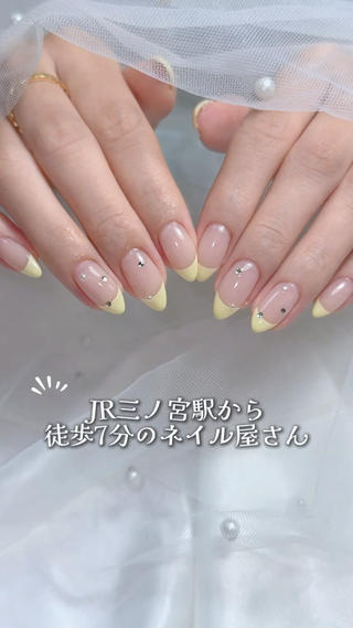 イエロー×フレンチ