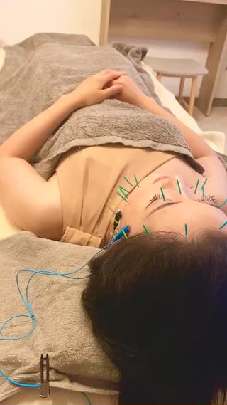 美容鍼
普段使わない筋肉を動かして
笑顔が素敵に♡