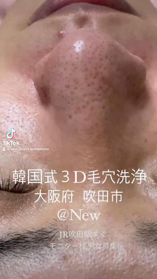 【大阪府吹田市初!】韓国式3D毛穴洗浄
お肌に負担なく浮かせてとる!
めちゃくちゃすっきり綺麗になります。
男女モニター様募集