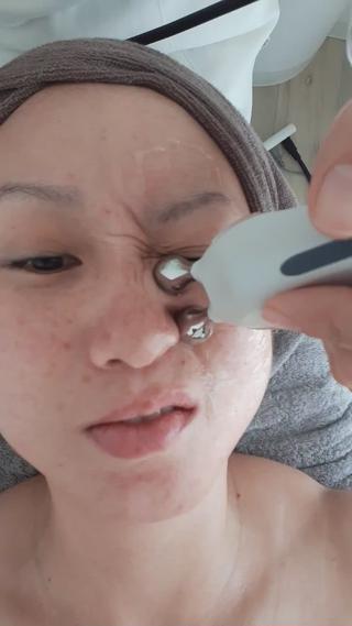 EMSでの表情筋の筋トレです
悪巧みをしてそうなくらい勝手に筋肉が動きます(笑)
動きには個人差があります。
ほどよい電力に調整できますので、痛くもなくクセになる気持ちよさ
筋肉を動かしているので、血流・透明感が更にアップでスッキリ&ほほ・目元・まゆなど全体的に引き上がります
オールハンドエステ施術後、美容液+パックを乗せる前のオプション(エステ料金+2,200円)になります。