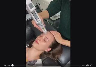 ニードルレスインジェクターの実際の施術動画
痛みはありません