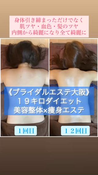 ブライダルエステ 美容整体・筋膜オイルのエステ・リラクイメージ