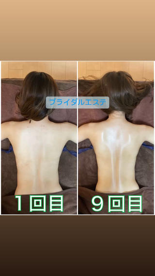 ブライダルエステ 美容整体・筋膜オイルのエステ・リラクイメージ