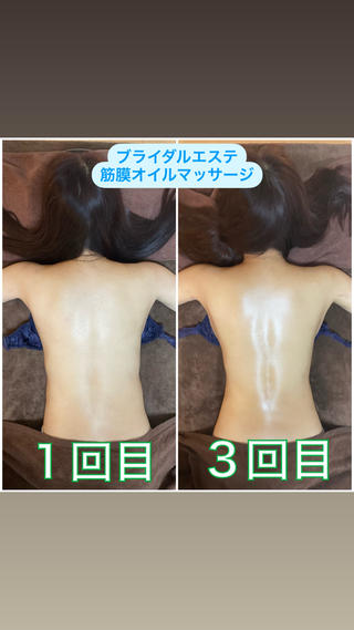 ブライダルエステ 美容整体・筋膜オイルのエステ・リラクイメージ