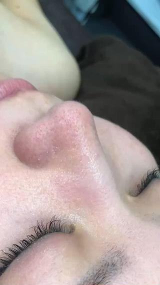 毛穴洗浄