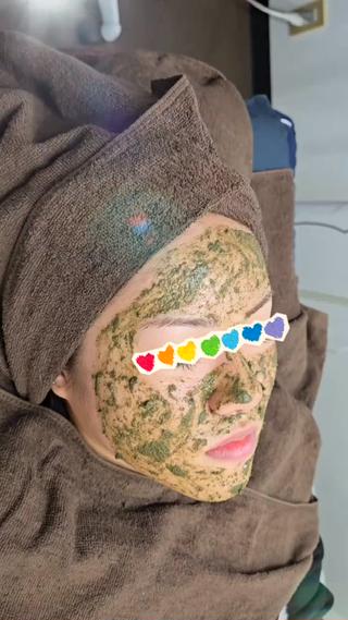 思春期ニキビにも効果バッチリ
ハーブピーリングでトラブル肌を解決