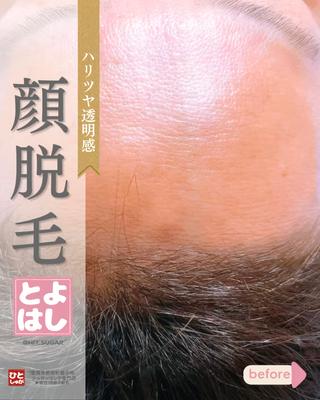豊橋 |Hitomi シュガーリング専門店のその他イメージ