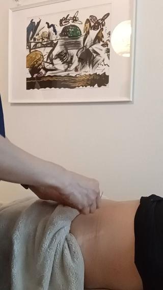 女性のお悩み鍼灸 美容鍼大浦あいのエステ・リラクイメージ