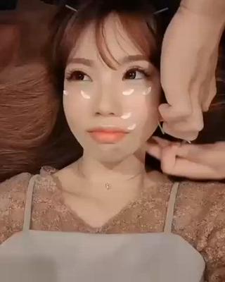 お肌の回復に美容鍼おすすめです！

#美容鍼#フェイシャル#御徒町#上野#完全個室#完全予約#メンズ美容鍼#ニキビ 