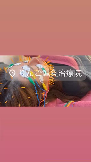 美容鍼灸女性専用 りんご鍼灸治療院のその他イメージ