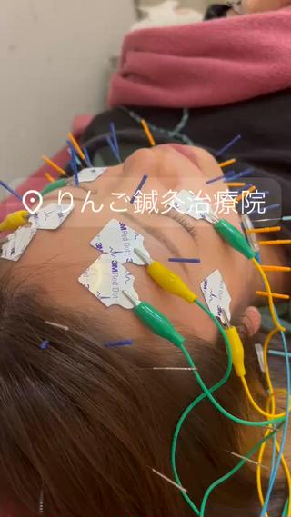 美容鍼灸女性専用 りんご鍼灸治療院のその他イメージ