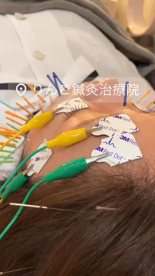 美容鍼灸女性専用 りんご鍼灸治療院のその他イメージ