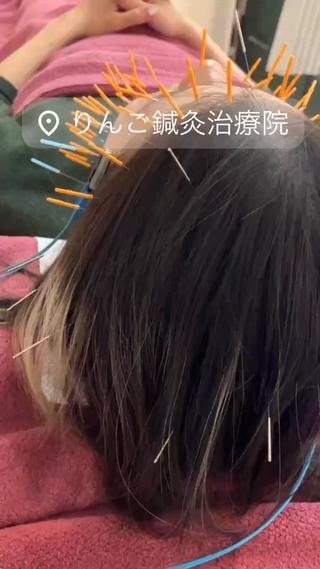 美容鍼灸女性専用 りんご鍼灸治療院のその他イメージ